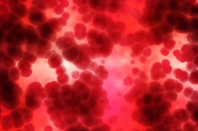 CAR-T免疫療法 有望治癒血癌復發