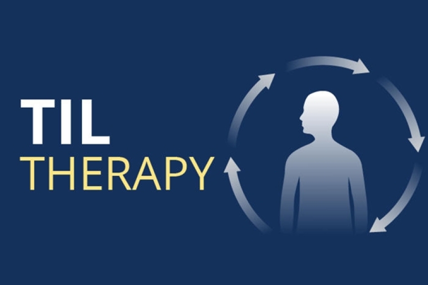 FDA批准第一個TIL療法用於治療晚期黑色素瘤