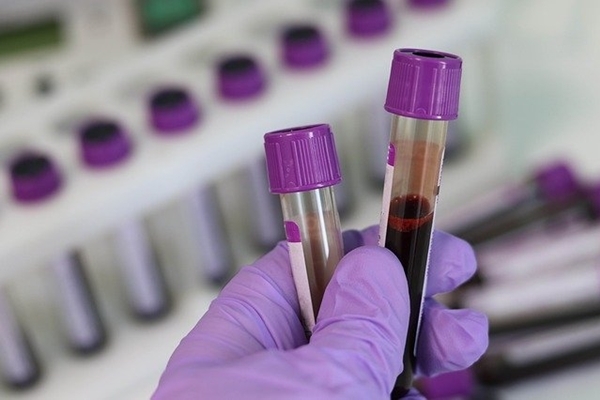 研究：抽血一次 能檢驗50種癌症