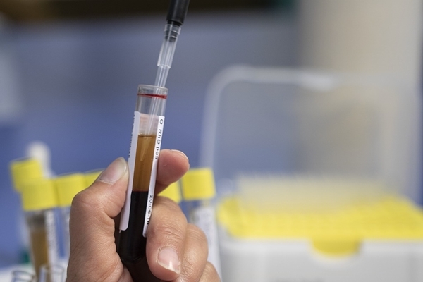 新的血液檢測方案 大幅提升肝癌篩檢準確度