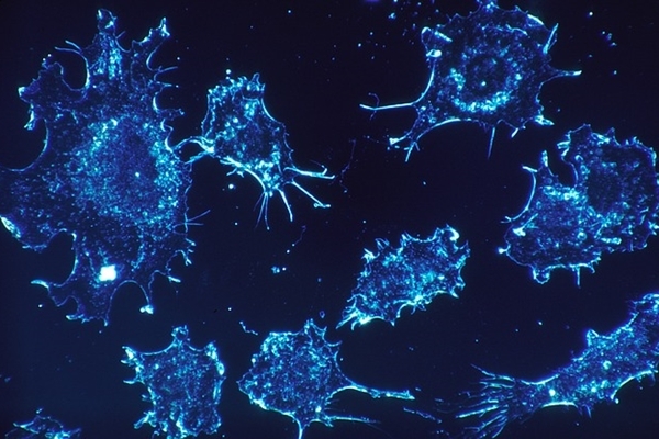 乳癌研究大逆轉 致癌基因可抑癌