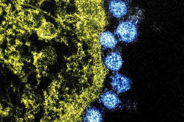 2019 新型冠狀病毒(n-CoV)，MERS和SARS
