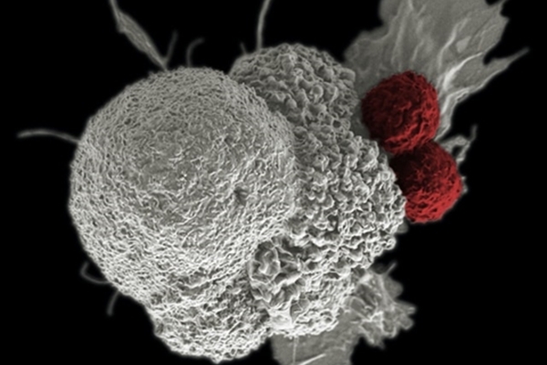 特管法細胞治療再添生力軍 衛福部首例通過DC-CIK治療實體癌