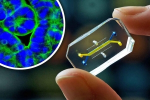 The Wyss Institute’s gut-on-a-chip constricts and relaxes, just as in the human body, producing finger-like projections called villi, shown at left