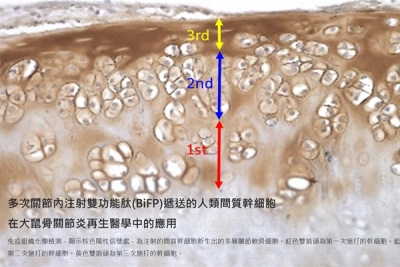 骨關節炎診斷治療新策略 「膠原結合胜肽」助關節軟骨成像、潤滑與再生