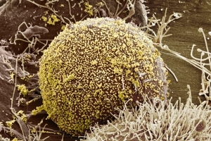 感染宿主細胞的黃色 HIV 顆粒的彩色掃描電子顯微照片