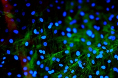 MSC的細胞膜顆粒有調節免疫反應的功能