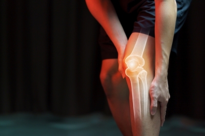 自體骨髓間質幹細胞治療退化性關節炎及膝關節軟骨缺損